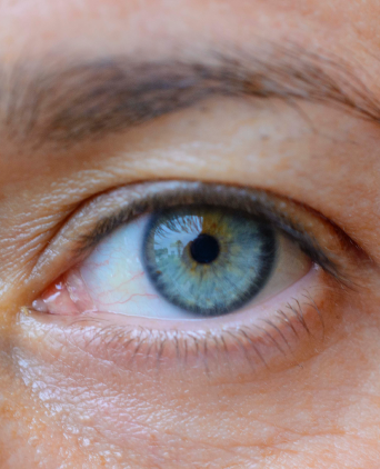 lacrimal system surgery